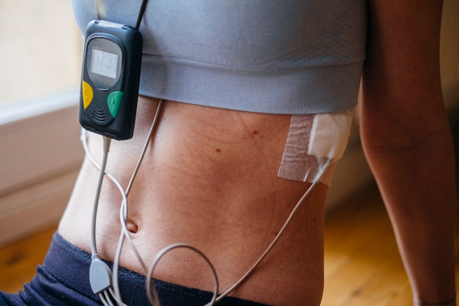Non-Invasive Cardiovascular Lab | Northern Heart Hospital