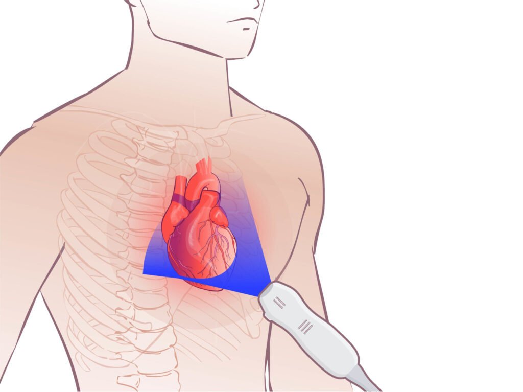 Echocardiogram Penang - What Exactly Is an Echocardiogram