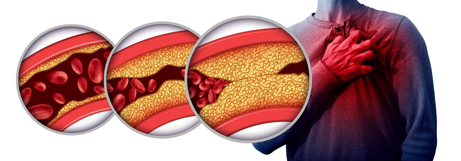 Common Heart Conditions and Symptoms