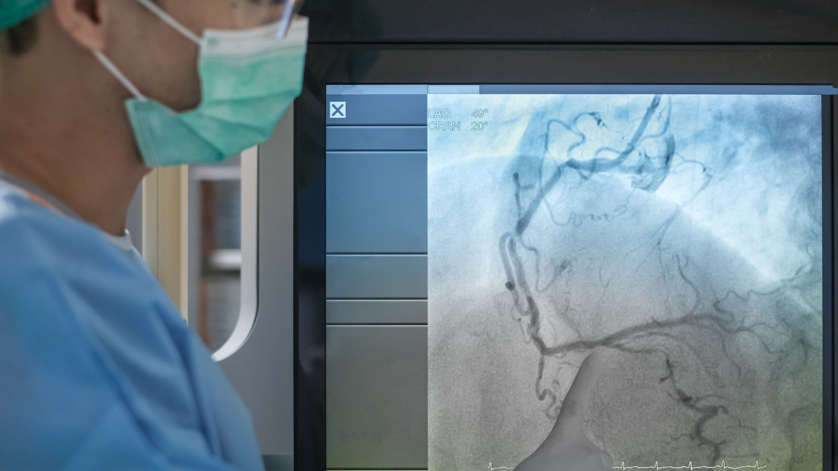 coronary angiography feature image