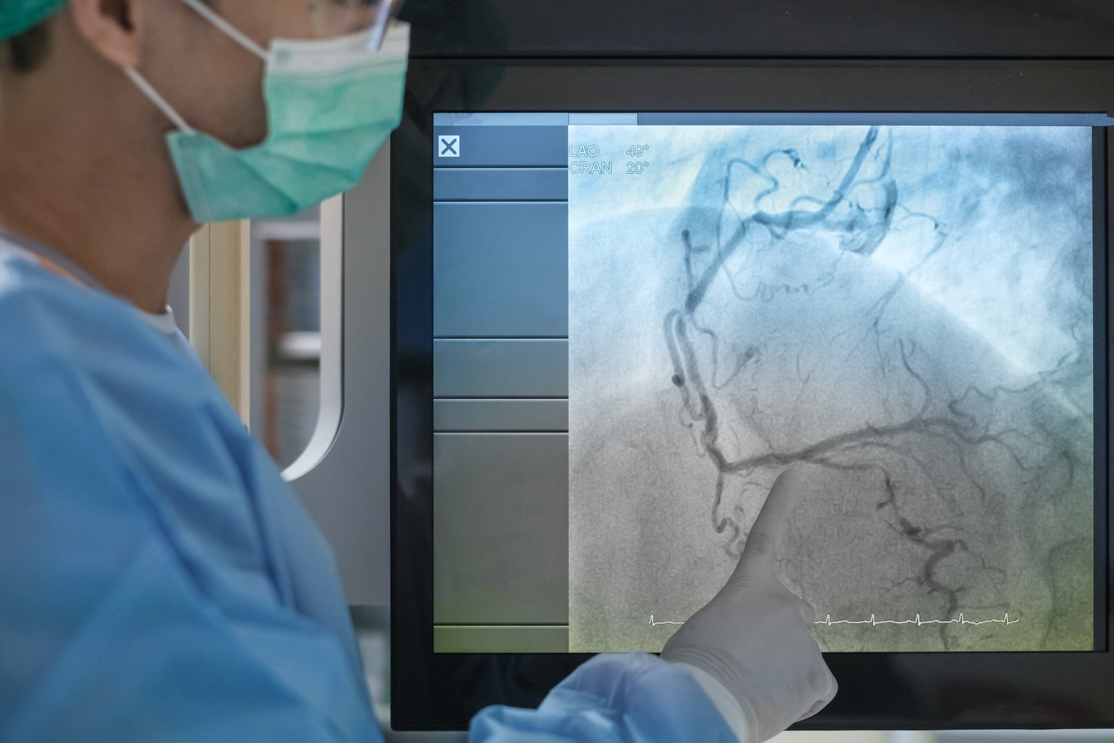 State-of-the-art coronary angiography equipment at Northern Heart Hospital.