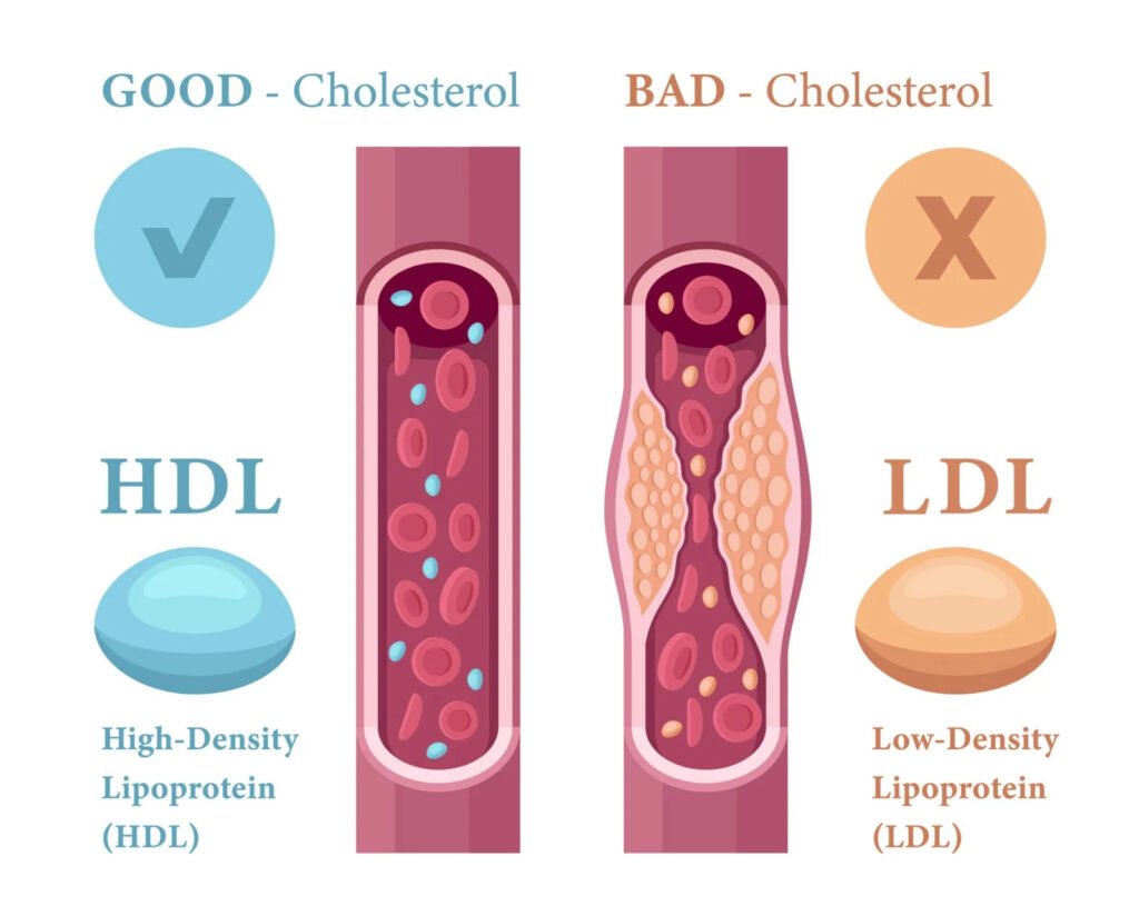 Step-by-Step-Guide-to-Managing-High-Cholesterol-Understanding-LDL-vs-HDL-scaled