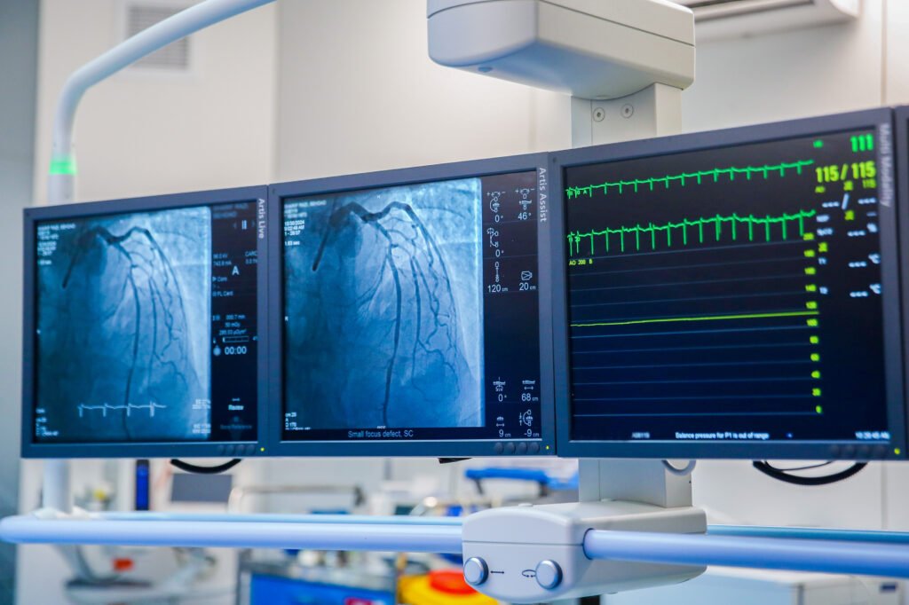 Coronary CT Angiogram