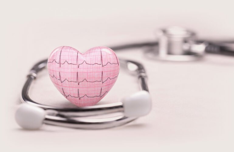 Heart arrhythmia